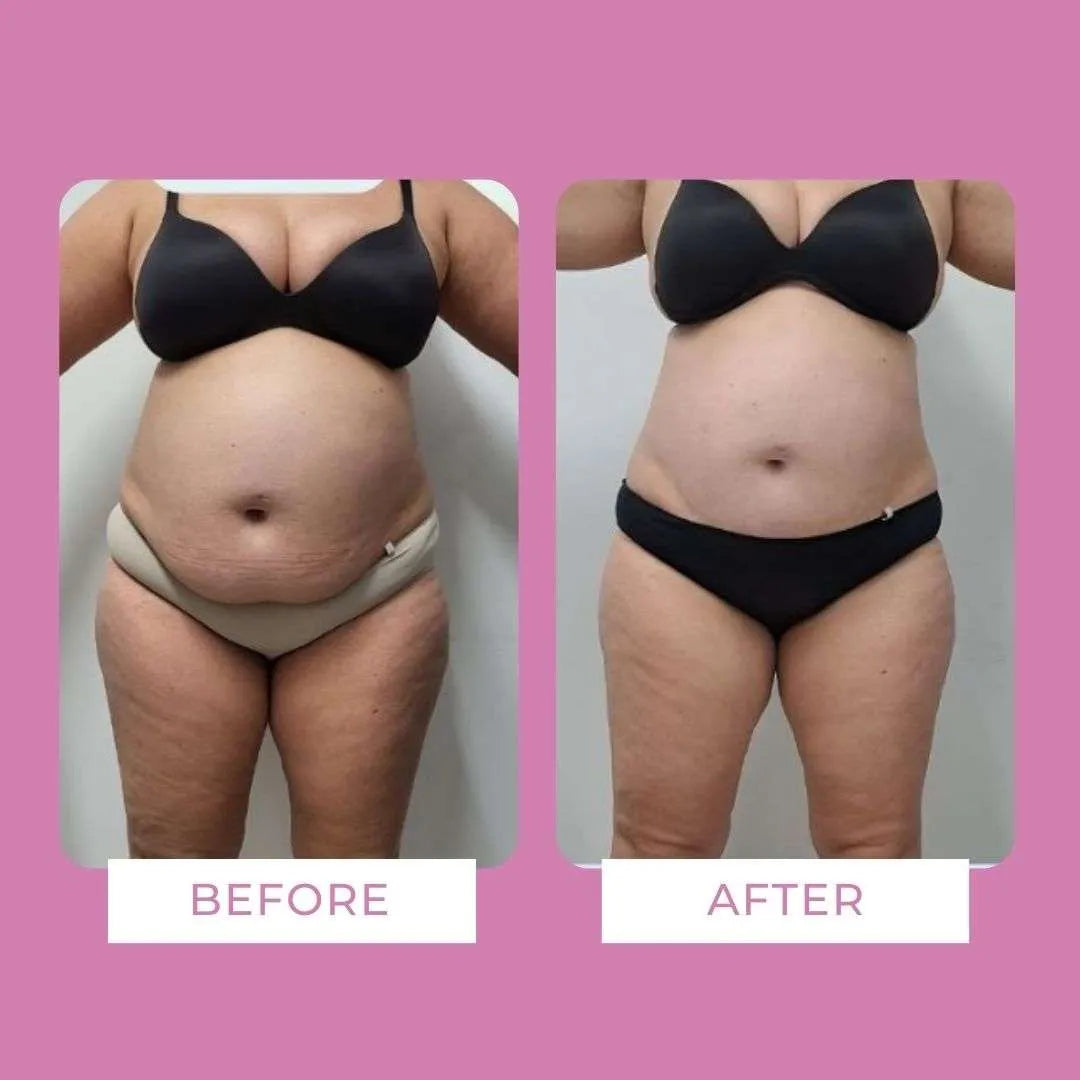 Body Sculpt Drenante