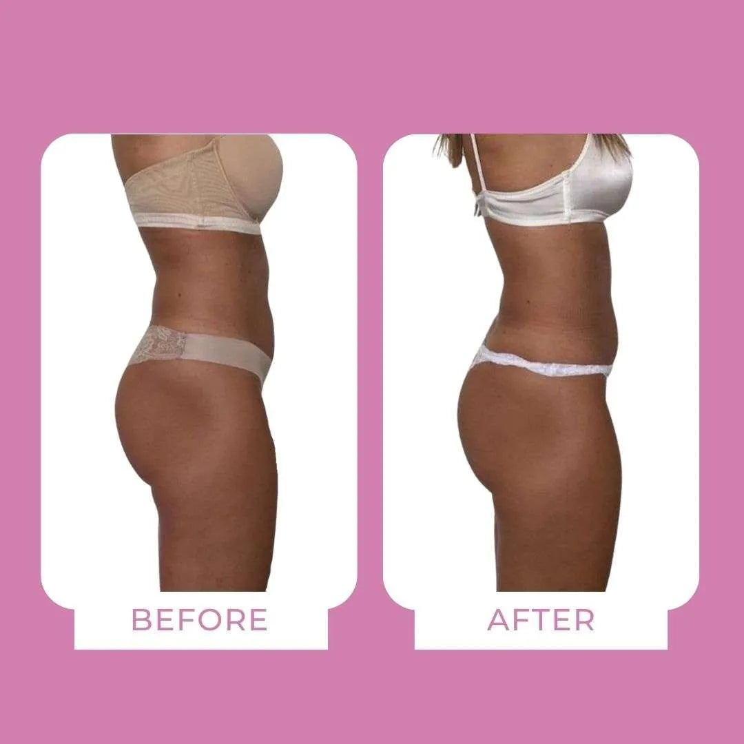 Body Sculpt Drenante