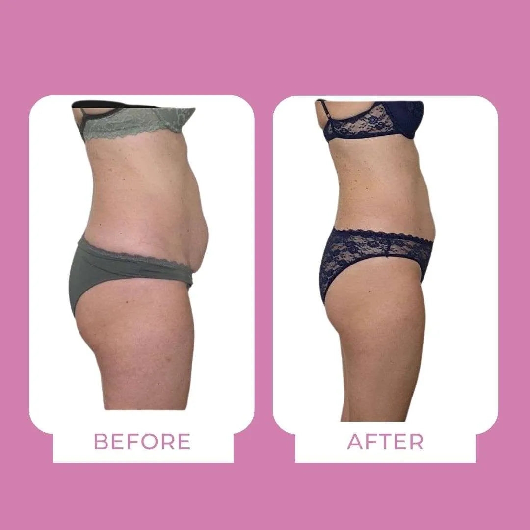 Body Sculpt Drenante