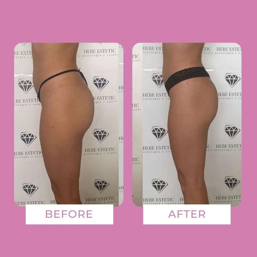 Body Sculpt Drenante