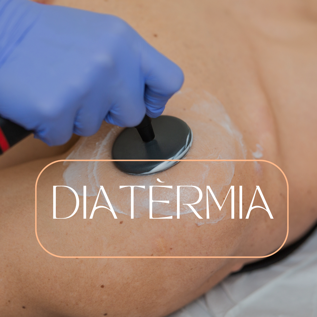 Diatèrmia